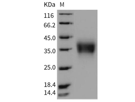Recombinant Rat CD32b/FCGR2B Protein (His Tag)(Active)