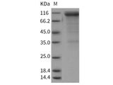Recombinant Rat CD36/SCARB3 Protein (Fc Tag)