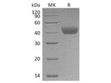 Recombinant Rat CD38 Protein (His Tag)