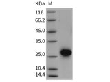 Recombinant Rat CD40/TNFRSF5 Protein (His Tag)
