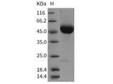 Recombinant Rat CD5 Protein (His Tag)(Active)