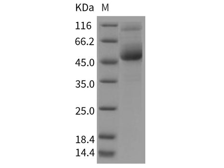Recombinant Rat CD7 Protein (Fc Tag)