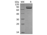 Recombinant Rat CD73/NT5E Protein (His Tag)