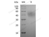 Recombinant Rat CD86/B7-2 Protein (His Tag)(Active)