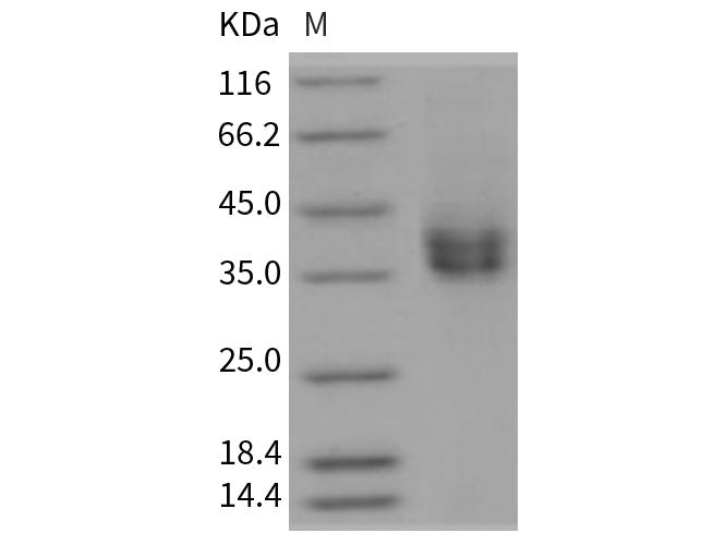 Recombinant Rat CD89/FCAR Protein (His Tag)