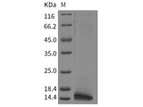 Recombinant Rat CLPS/Colipase Protein (His Tag)