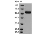 Recombinant Rat CNTFR/CNTFR-alpha Protein (His Tag)(Active)