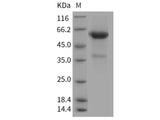 Recombinant Rat COL4A3 Protein (Fc Tag)