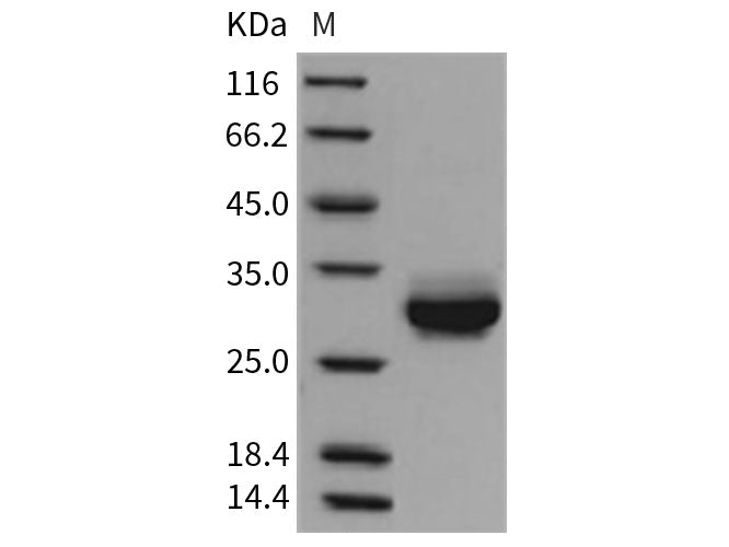 Recombinant Rat CRP/C-Reactive Protein (His Tag) Stored at -20 to -80℃