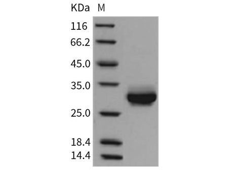 Recombinant Rat CRP/C-Reactive Protein (His Tag) Stored at -20 to -80℃