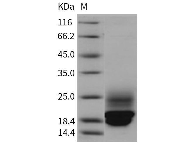 Recombinant Rat Cystatin C/CST3 Protein (His Tag)