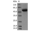 Recombinant Rat DDR1 Kinase/CD167 Protein (His Tag)