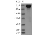 Recombinant Rat EGFR/ErbB1 Protein (His Tag)(Active)