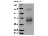 Recombinant Rat FAS/CD95/APO-1/TNFRSF6 Protein (His Tag)(Active)
