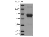 Recombinant Rat FCGR1A/CD64 Protein (His Tag)(Active)