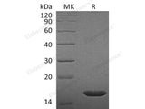 Recombinant Rat FGF-2/FGFb Protein (Active)