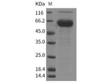 Recombinant Rat FOLR1 Protein (Fc Tag)