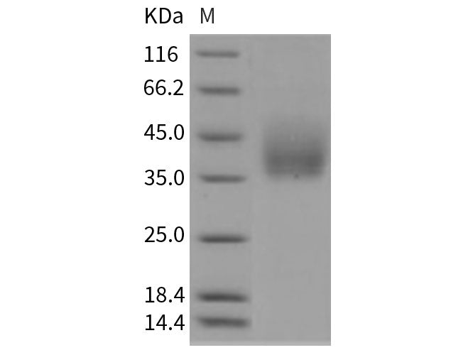 Recombinant Rat Growth Hormone Receptor/GHR Protein (His Tag)(Active)