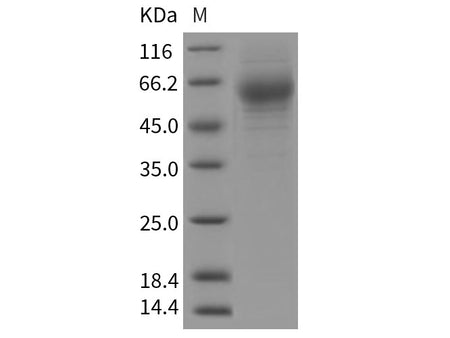 Recombinant Rat HepaCAM2 Protein (Fc Tag)
