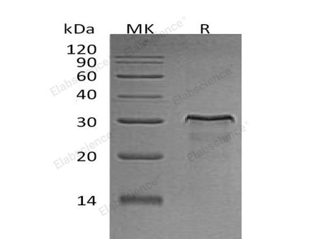 Recombinant Rat HER2/ErbB2 Protein (aa 4-656, His Tag)