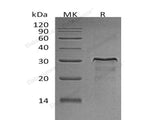 Recombinant Rat HER2/ErbB2 Protein (aa 4-656, His Tag)