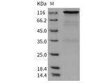 Recombinant Rat HER2/ErbB2 Protein (Fc Tag)