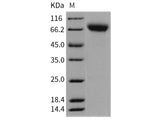 Recombinant Rat ICAM-1/CD54 Protein (His Tag)(Active)