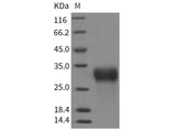 Recombinant Rat IGFBP6/IBP6 Protein (His Tag)