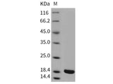 Recombinant Rat IL-1 beta/IL1B Protein (mature form)(Active)