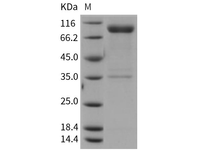 Recombinant Rat IL1R1/CD121a Protein (His & Fc Tag)(Active)