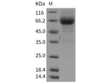 Recombinant Rat IL4RA/CD124 Protein (Fc Tag)(Active)