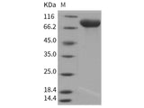 Recombinant Rat IL6ST/CD130 Protein (His Tag)(Active)