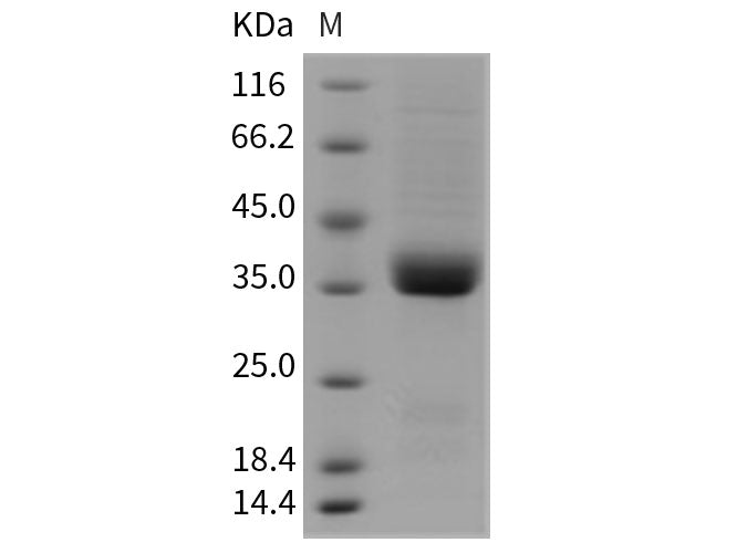 Recombinant Rat IL9R/Interleukin 9 receptor Protein (His Tag)