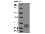 Recombinant Rat Interleukin-17F/IL-17F Protein (His Tag)(Active)