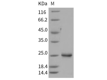 Recombinant Rat LCN2/NGAL Protein (His Tag)(Active)