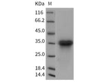 Recombinant Rat LTBR/TNFRSF3 Protein (His Tag)