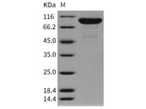 Recombinant Rat MMP-9 Protein (His Tag)(Active)