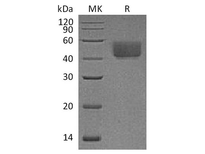 Recombinant Rat PD-L1/B7-H1/CD274 Protein (C-His)