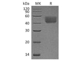 Recombinant Rat PD-L1/B7-H1/CD274 Protein (C-His)