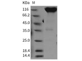 Recombinant Rat PDGFRa/CD140a Protein (Fc Tag)