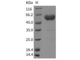 Recombinant Rat Podoplanin/PDPN Protein (ECD, Fc Tag)