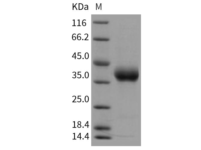 Recombinant Rat PRLR/Prolactin Receptor Protein (His Tag)