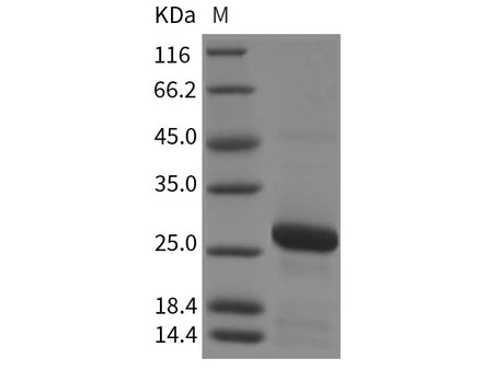 Recombinant Rat RAB7A/Rab-7a Protein (His Tag)