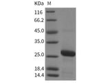 Recombinant Rat RAB7A/Rab-7a Protein (His Tag)