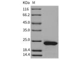 Recombinant Rat RBP4 Protein (His Tag)(Active)