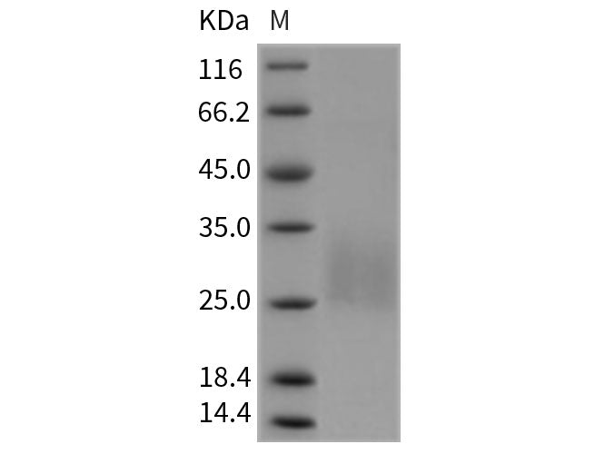 Recombinant Rat REG4 Protein (His Tag) Stored at -20 to -80℃