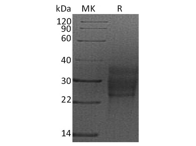 Recombinant Rat SCF/c-Kit Ligand Protein (Human Cells, His Tag)