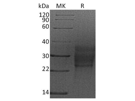 Recombinant Rat SCF/c-Kit Ligand Protein (Human Cells, His Tag)