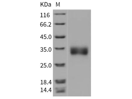 Recombinant Rat Sclerostin/SOST Protein (His Tag)