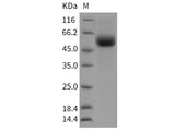 Recombinant Rat TGFBR2 Protein (Fc Tag)